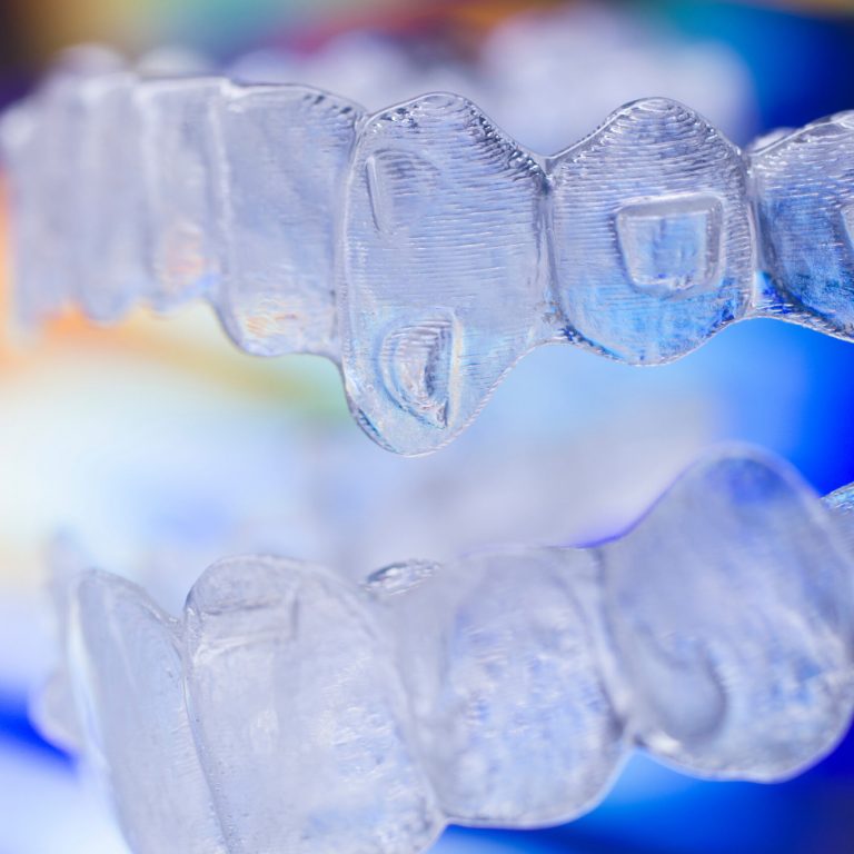 Invisible modern plastic aesthtic dentistry dental brackets teeth aligner straighteners.